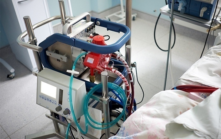One more ECMO Patient dies at SCB, Cuttack