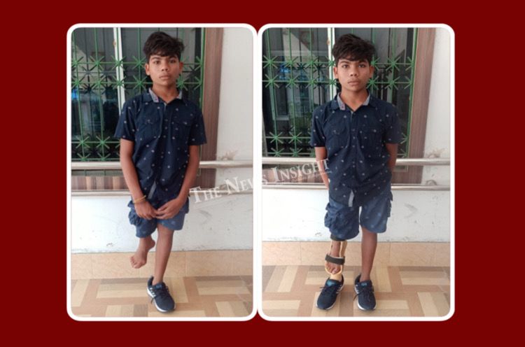 Young Boy gets to Walk with a Smile; thanks Odisha-Mo Parivar